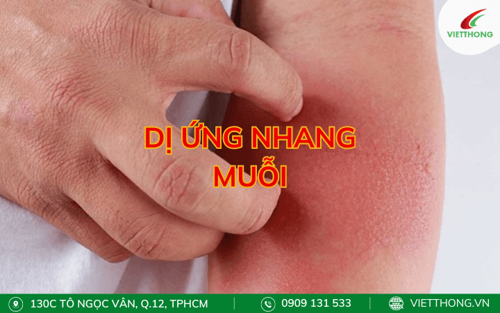 Triệu chứng dị ứng nhang muỗi