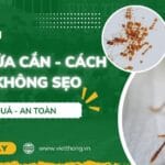 Kiến lửa cắn cánh xử lý không sẹo