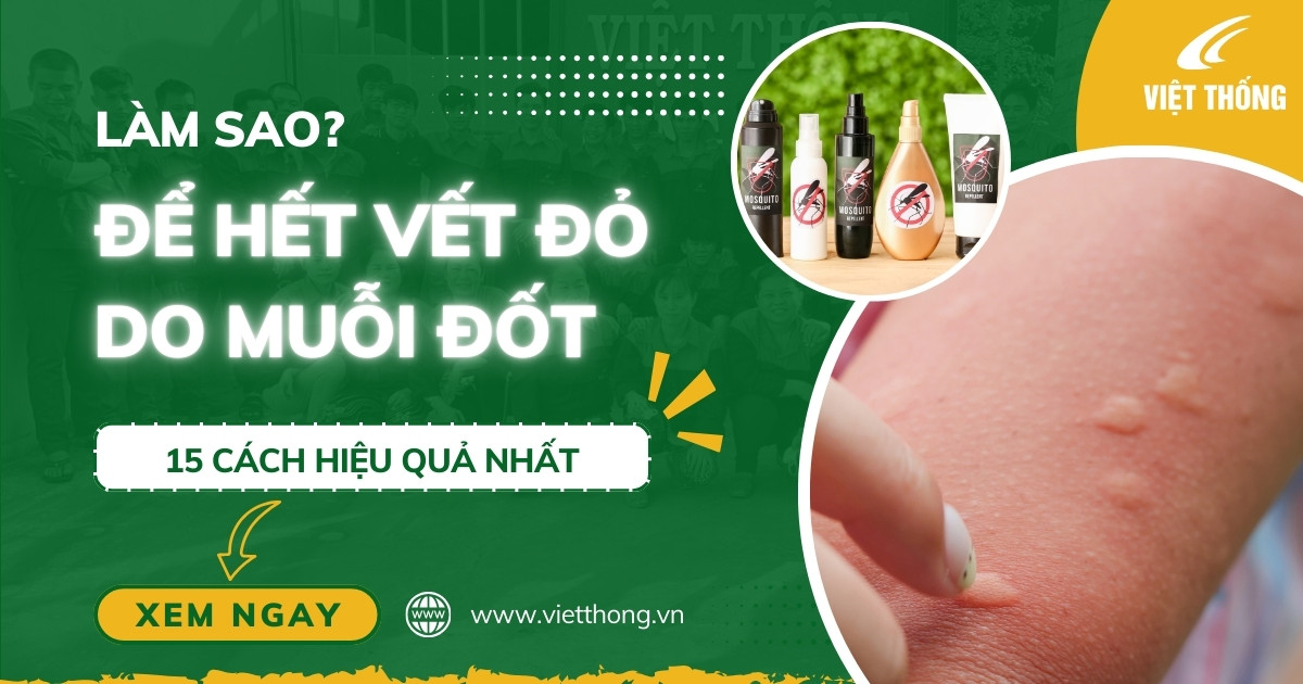 Làm sao để hết vết đỏ do muỗi đốt