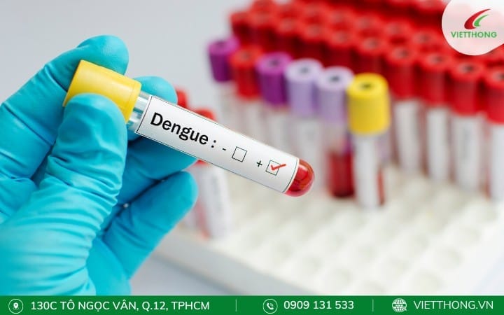 Chẩn đoán virus dengue
