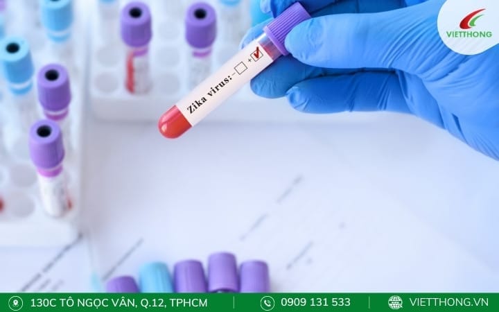 Phương pháp chẩn đoán & điều trị Virus Zika